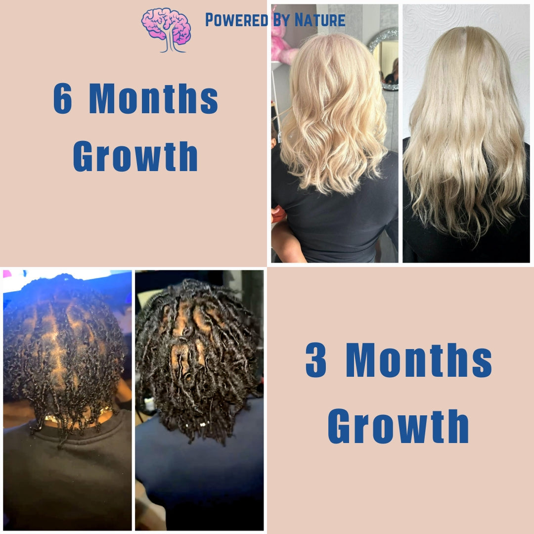 Before and after hair growth comparisons showing 3 and 6 months of results on different hair types.